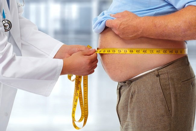 Cara Cegah Obesitas: Menjaga Kesehatan Tubuh dengan Bersahabat